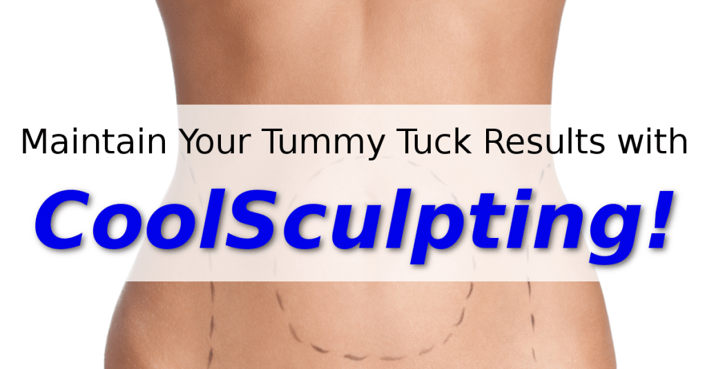 Maintain Your Tummy Tuck Results with CoolSculpting! Dr. Shel