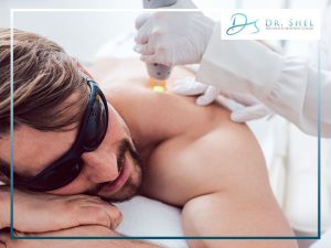 Laser Treatment Sugar Land TX