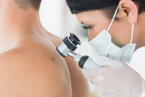 Know the ABCs of Checking for Skin Cancer