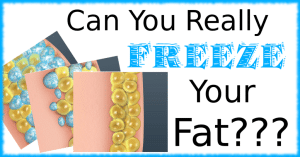 Can You Really FREEZE Fat?