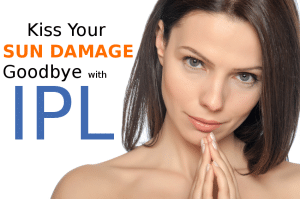 Remove Sun Damaged Skin with an Intense Pulsed Light (IPL) Therapy