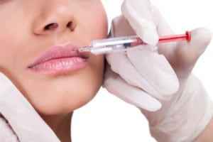 Consider Juvederm® Injectible Gel For Fuller, More Kissable Lips