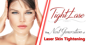 Fotona TightLase: The Next Generation of Laser Skin Tightening!