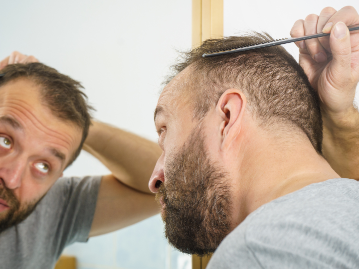 PRP for Hair Restoration