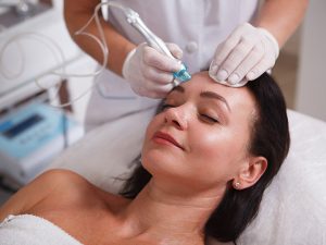 What Is Microneedling with PRP in Sugar Land, TX?