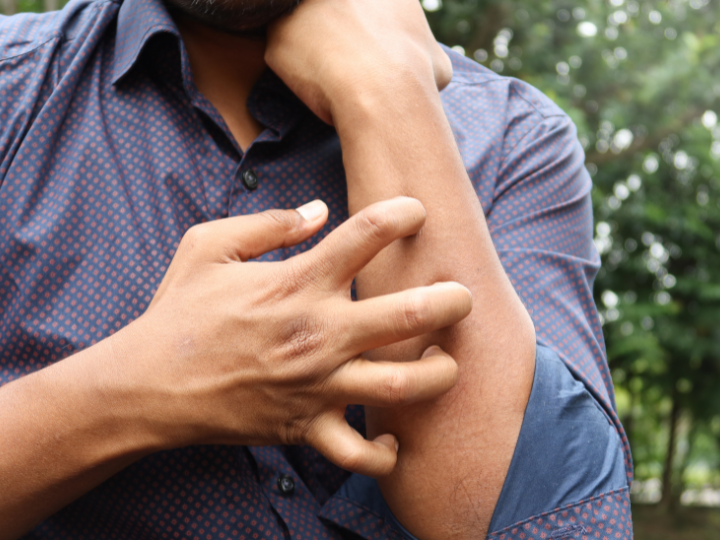 Seasonal Allergy Testing & Treatment