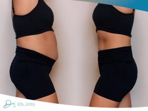 Medical Weight Loss Sugar Land TX